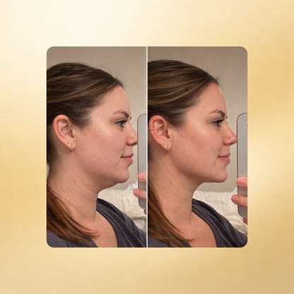 Parches Anti-Papada con colageno Celesté®